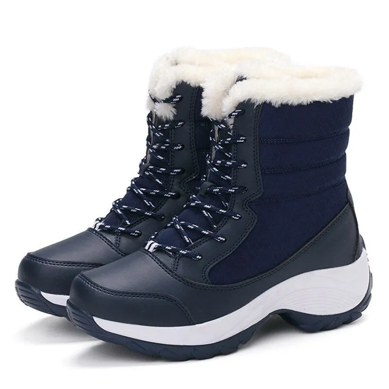 Dyavor Women Thick Fur High Heel Orthopedic Boots